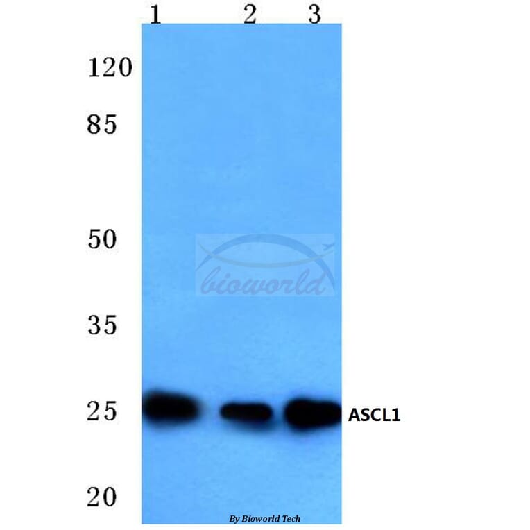 Anti-ASCL1 (E158) Antibody from Bioworld Technology (BS3688) - Antibodies.com