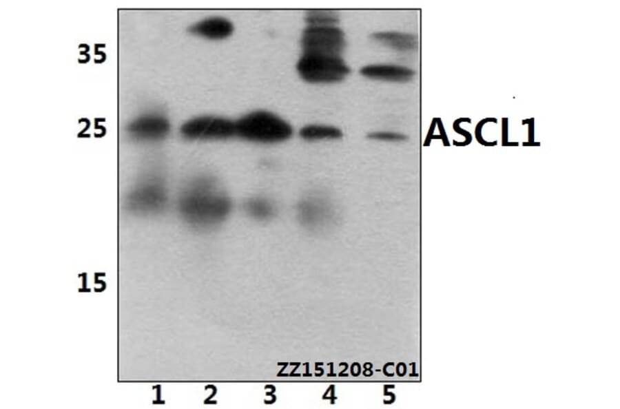 Anti-ASCL1 (E158) Antibody from Bioworld Technology (BS3688) - Antibodies.com