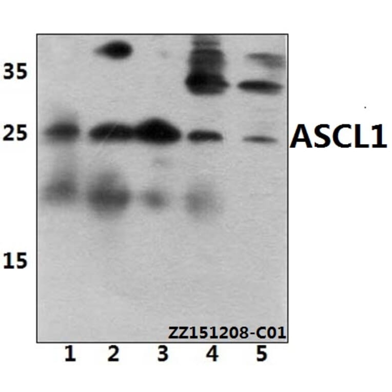 Anti-ASCL1 (E158) Antibody from Bioworld Technology (BS3688) - Antibodies.com