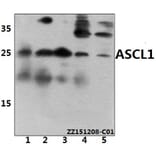 Anti-ASCL1 (E158) Antibody from Bioworld Technology (BS3688) - Antibodies.com