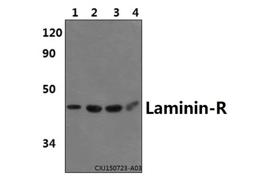 Anti-Laminin-R (Q215) Antibody from Bioworld Technology (BS3689) - Antibodies.com