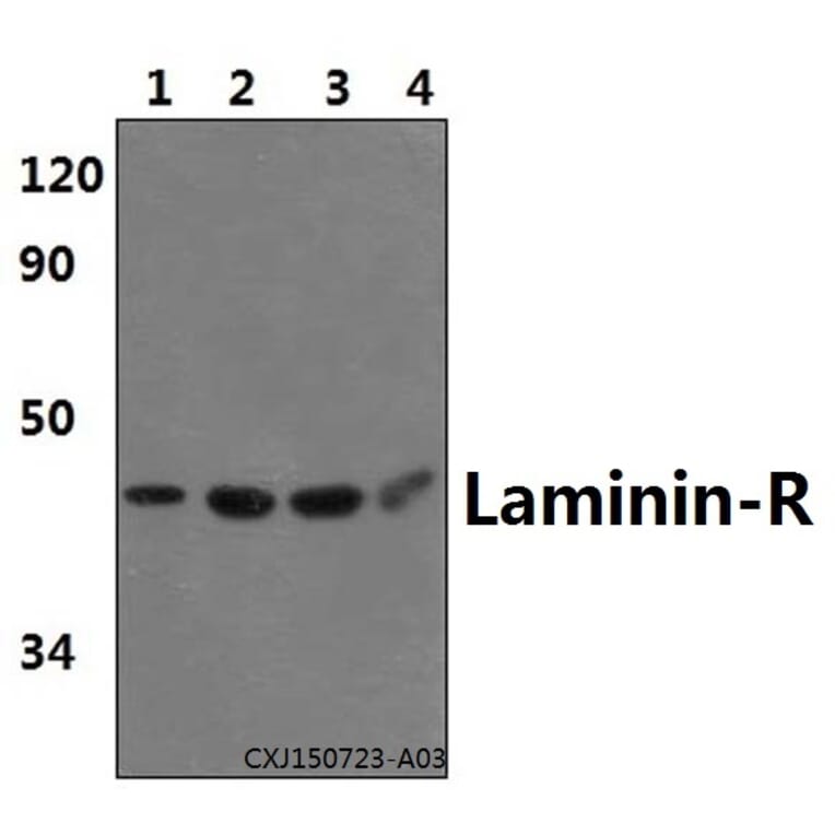 Anti-Laminin-R (Q215) Antibody from Bioworld Technology (BS3689) - Antibodies.com