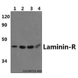 Anti-Laminin-R (Q215) Antibody from Bioworld Technology (BS3689) - Antibodies.com