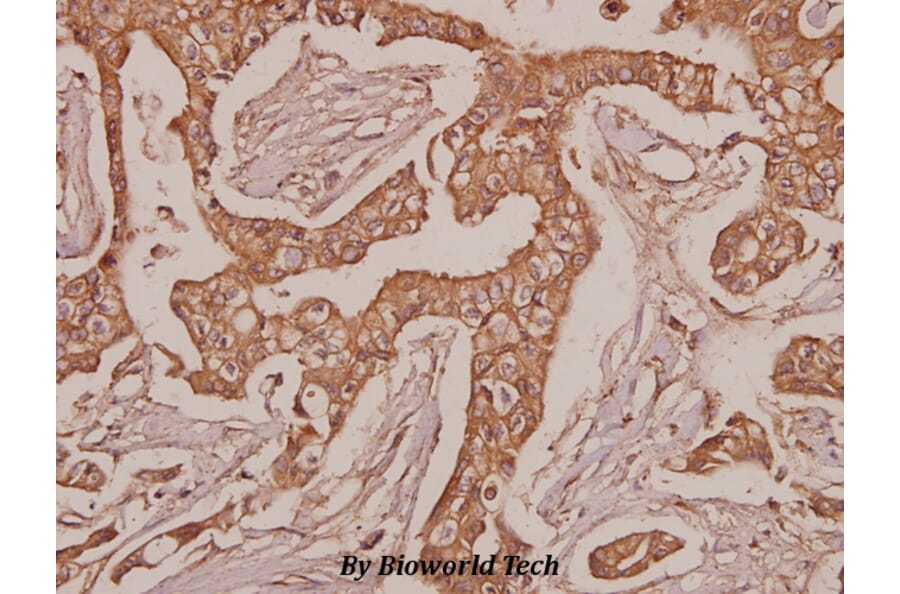 Anti-Laminin-R (Q215) Antibody from Bioworld Technology (BS3689) - Antibodies.com