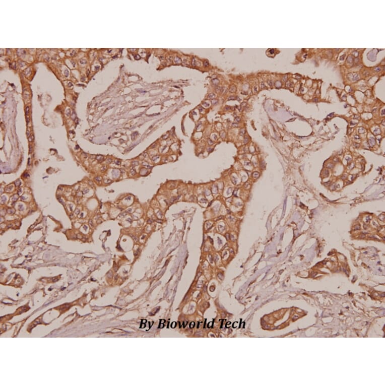 Anti-Laminin-R (Q215) Antibody from Bioworld Technology (BS3689) - Antibodies.com