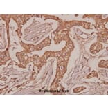 Anti-Laminin-R (Q215) Antibody from Bioworld Technology (BS3689) - Antibodies.com