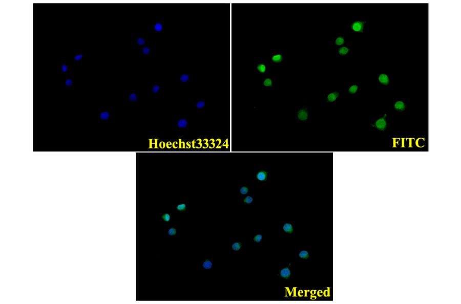 Anti-Laminin-R (Q215) Antibody from Bioworld Technology (BS3689) - Antibodies.com
