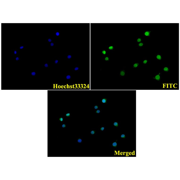 Anti-Laminin-R (Q215) Antibody from Bioworld Technology (BS3689) - Antibodies.com