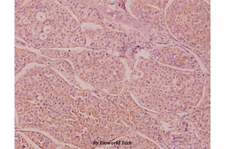Anti-IL-16 (G97) Antibody from Bioworld Technology (BS3690) - Antibodies.com