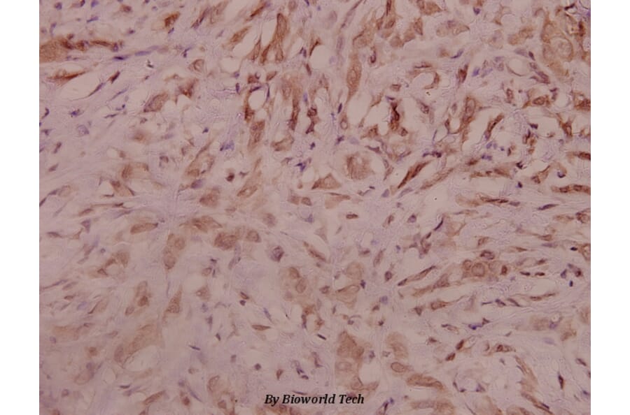 Anti-SEMA3A (P737) Antibody from Bioworld Technology (BS3691) - Antibodies.com
