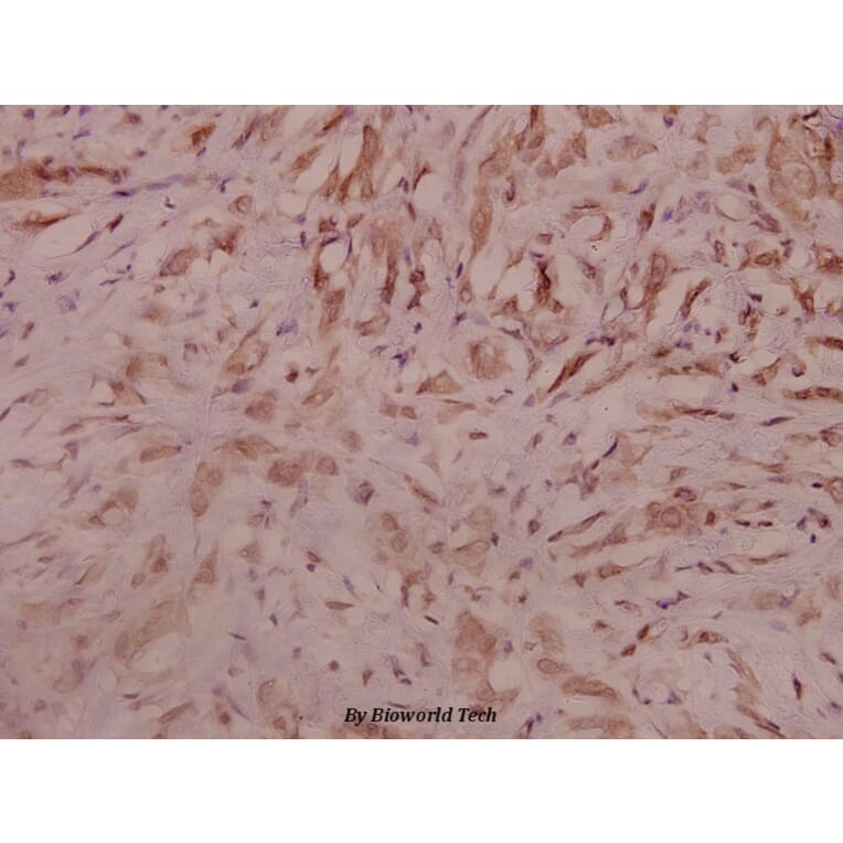 Anti-SEMA3A (P737) Antibody from Bioworld Technology (BS3691) - Antibodies.com