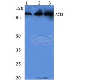 Anti-ACE2 (K465) Antibody from Bioworld Technology (BS3692) - Antibodies.com