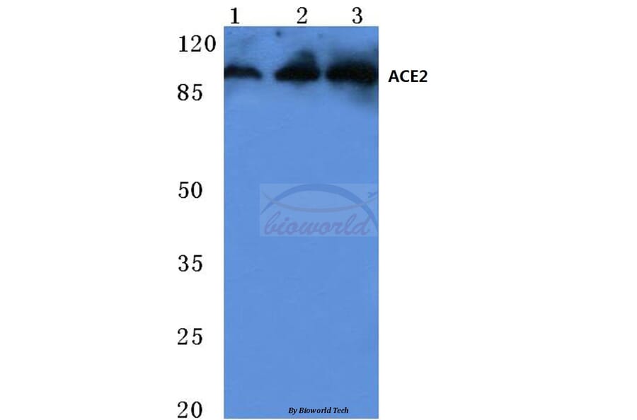 Anti-ACE2 (K465) Antibody from Bioworld Technology (BS3692) - Antibodies.com
