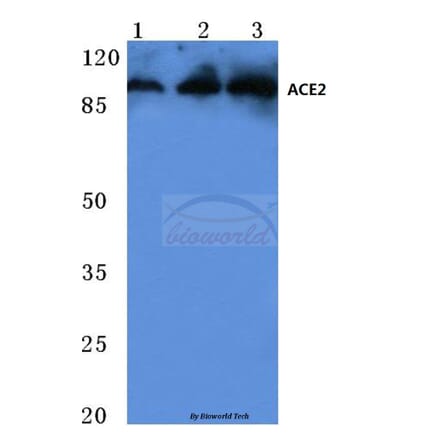 Anti-ACE2 (K465) Antibody from Bioworld Technology (BS3692) - Antibodies.com
