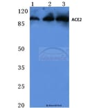 Anti-ACE2 (K465) Antibody from Bioworld Technology (BS3692) - Antibodies.com
