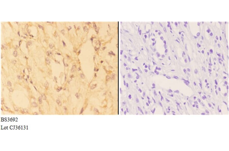 Anti-ACE2 (K465) Antibody from Bioworld Technology (BS3692) - Antibodies.com
