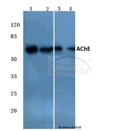 Anti-AChE (K585) Antibody from Bioworld Technology (BS3694) - Antibodies.com