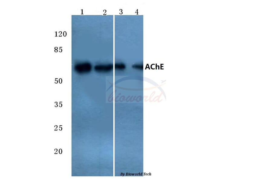 Anti-AChE (K585) Antibody from Bioworld Technology (BS3694) - Antibodies.com