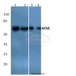 Anti-AChE (K585) Antibody from Bioworld Technology (BS3694) - Antibodies.com