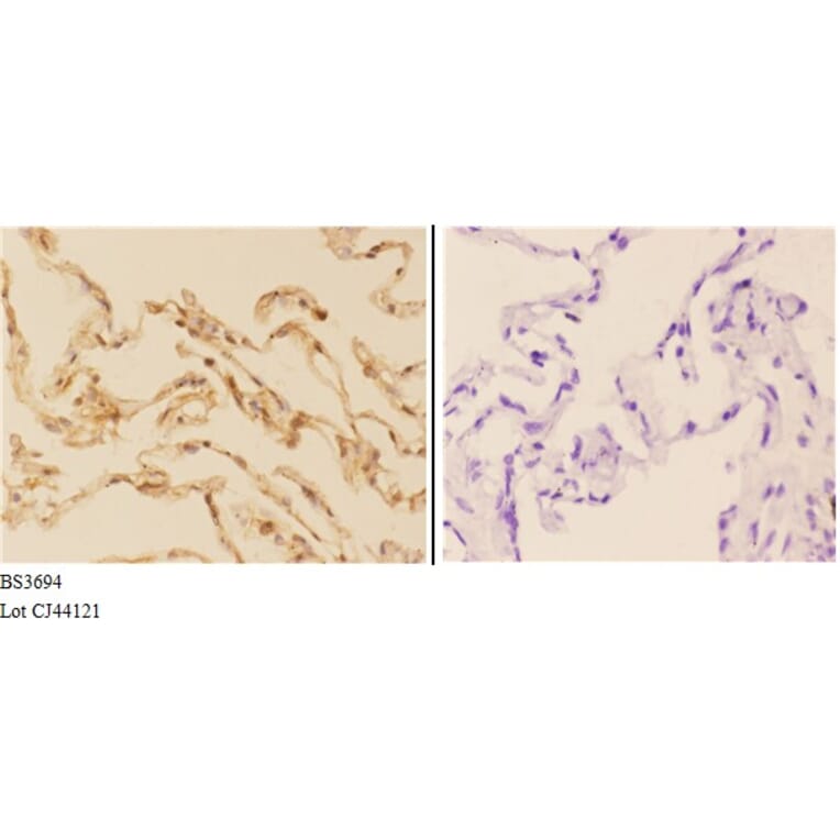 Anti-AChE (K585) Antibody from Bioworld Technology (BS3694) - Antibodies.com