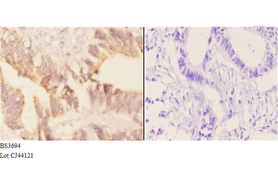 Anti-AChE (K585) Antibody from Bioworld Technology (BS3694) - Antibodies.com
