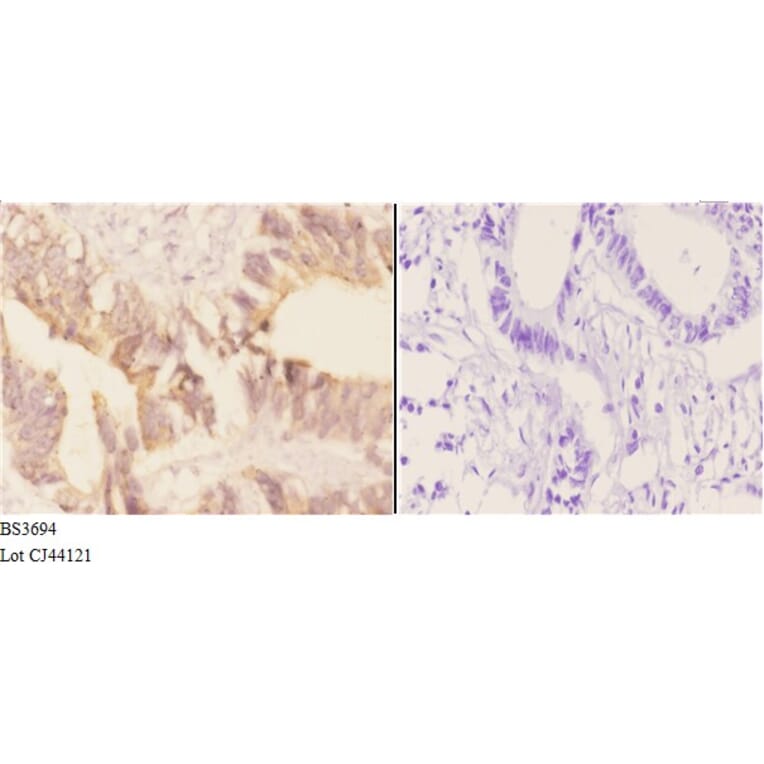 Anti-AChE (K585) Antibody from Bioworld Technology (BS3694) - Antibodies.com
