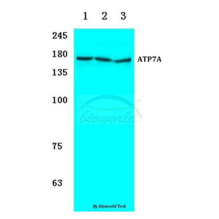Anti-ATP7A (H640) Antibody from Bioworld Technology (BS3695) - Antibodies.com
