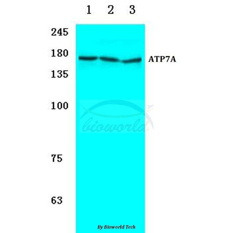 Anti-ATP7A (H640) Antibody from Bioworld Technology (BS3695) - Antibodies.com