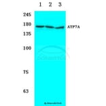 Anti-ATP7A (H640) Antibody from Bioworld Technology (BS3695) - Antibodies.com