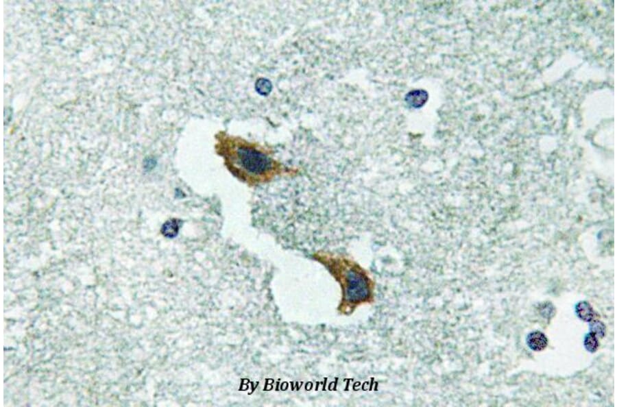 Anti-ATP7A (H640) Antibody from Bioworld Technology (BS3695) - Antibodies.com
