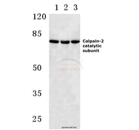 Anti-Calpain 2 (K354) Antibody from Bioworld Technology (BS3696) - Antibodies.com