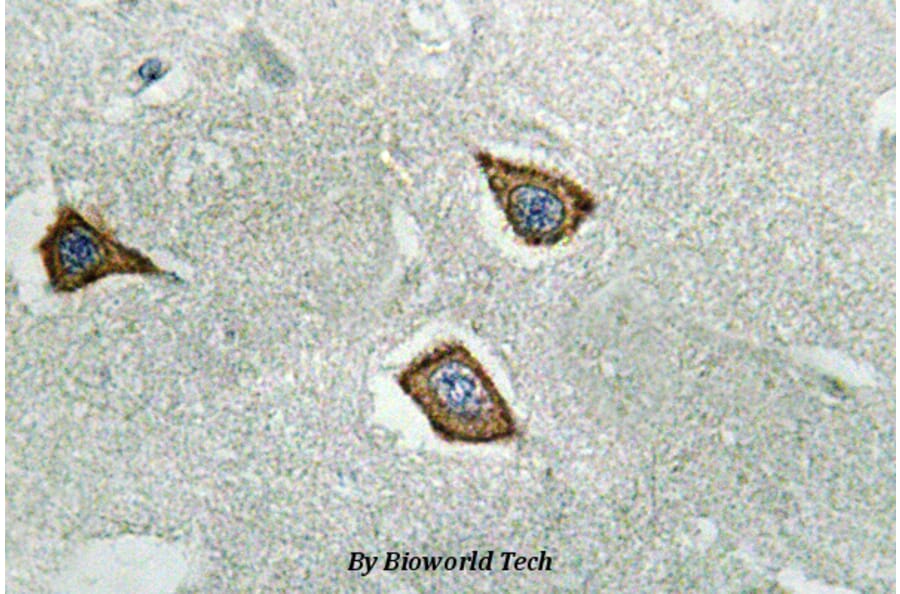 Anti-Calpain 2 (K354) Antibody from Bioworld Technology (BS3696) - Antibodies.com