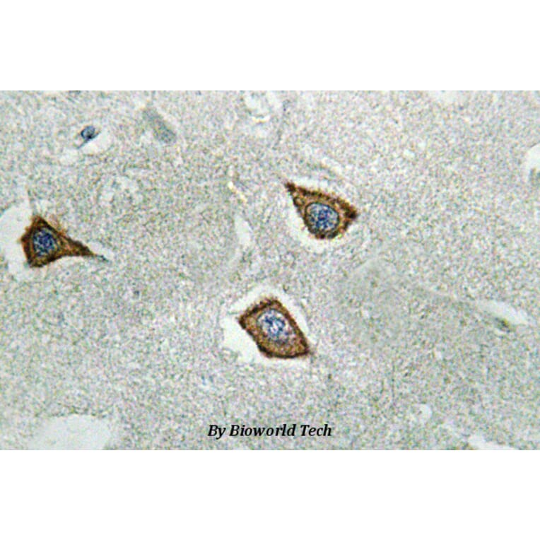 Anti-Calpain 2 (K354) Antibody from Bioworld Technology (BS3696) - Antibodies.com