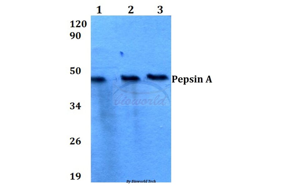 Anti-Pepsin A (M307) Antibody from Bioworld Technology (BS3697) - Antibodies.com