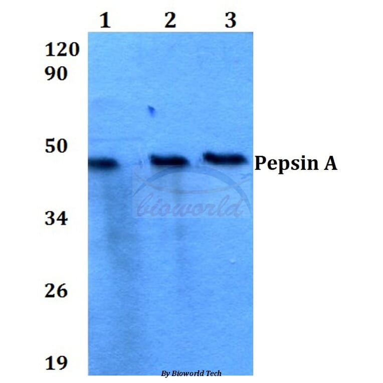 Anti-Pepsin A (M307) Antibody from Bioworld Technology (BS3697) - Antibodies.com