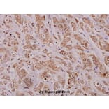 Anti-MMP-12 (D411) Antibody from Bioworld Technology (BS3699) - Antibodies.com