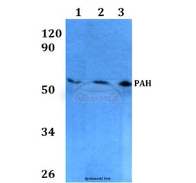 Anti-PAH (R400) Antibody from Bioworld Technology (BS3704) - Antibodies.com
