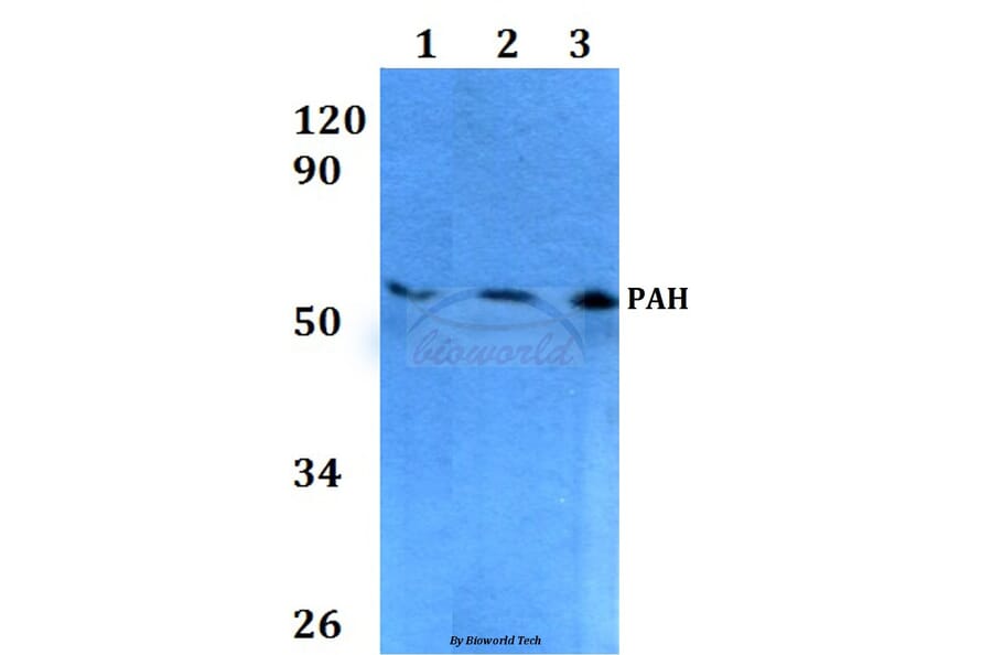 Anti-PAH (R400) Antibody from Bioworld Technology (BS3704) - Antibodies.com