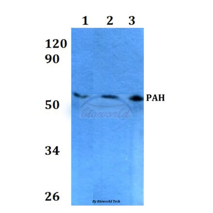 Anti-PAH (R400) Antibody from Bioworld Technology (BS3704) - Antibodies.com