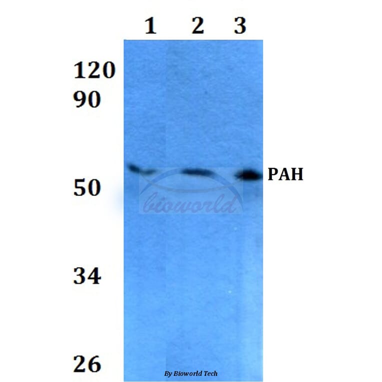 Anti-PAH (R400) Antibody from Bioworld Technology (BS3704) - Antibodies.com