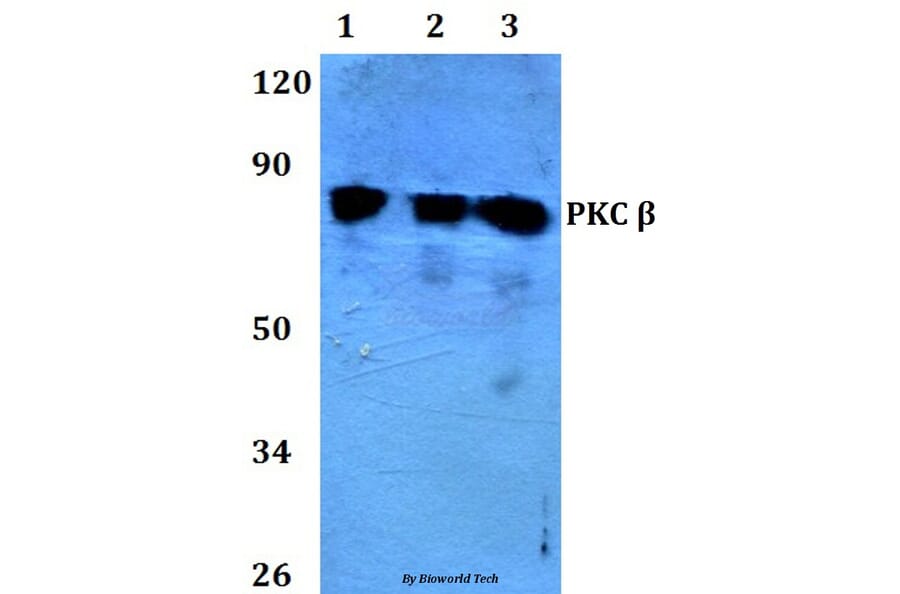 Anti-PKC β (N655) Antibody from Bioworld Technology (BS3708) - Antibodies.com