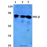 Anti-PKC β (N655) Antibody from Bioworld Technology (BS3708) - Antibodies.com