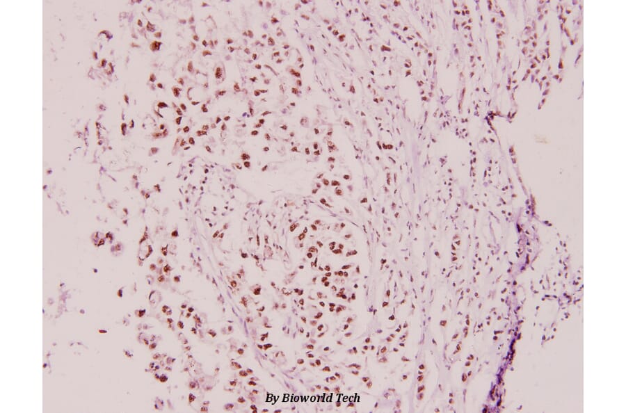Anti-Cyclin E2 (N387) Antibody from Bioworld Technology (BS3710) - Antibodies.com