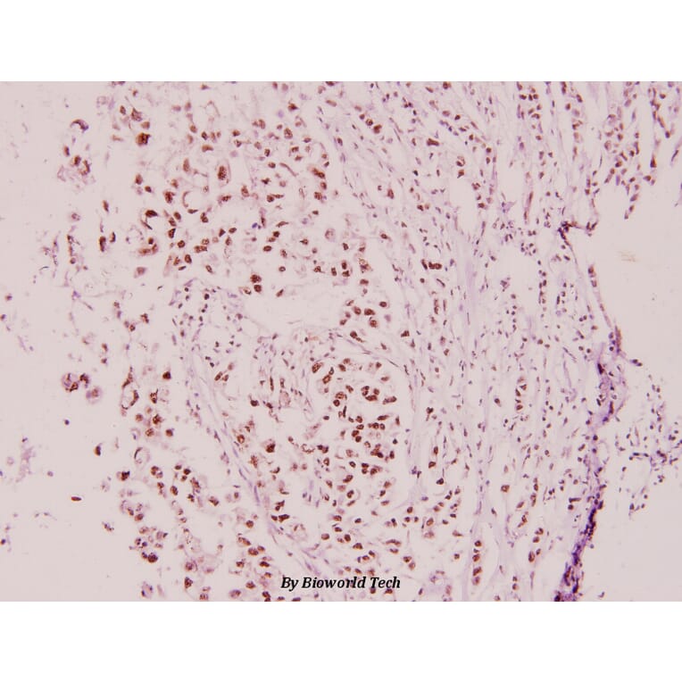 Anti-Cyclin E2 (N387) Antibody from Bioworld Technology (BS3710) - Antibodies.com