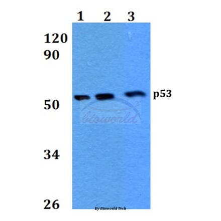 Anti-p53 (V31) Antibody from Bioworld Technology (BS3712) - Antibodies.com