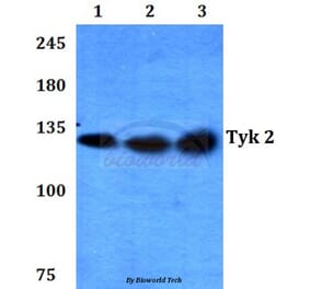 Anti-TYK2 (V1048) Antibody from Bioworld Technology (BS3713) - Antibodies.com