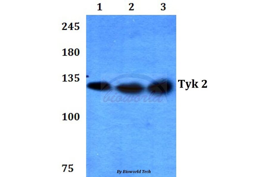 Anti-TYK2 (V1048) Antibody from Bioworld Technology (BS3713) - Antibodies.com