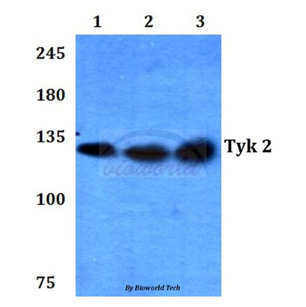 Anti-TYK2 (V1048) Antibody from Bioworld Technology (BS3713) - Antibodies.com