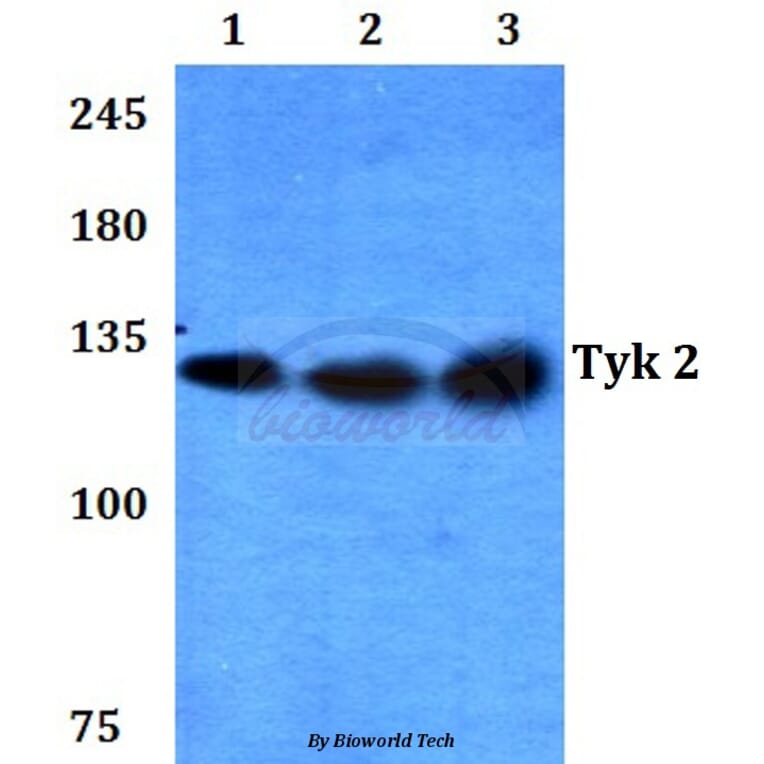 Anti-TYK2 (V1048) Antibody from Bioworld Technology (BS3713) - Antibodies.com