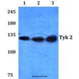 Anti-TYK2 (V1048) Antibody from Bioworld Technology (BS3713) - Antibodies.com